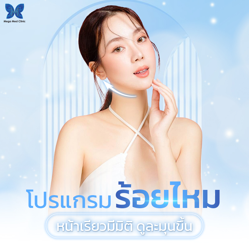 ปรับรูปหน้า ร้อยไหม