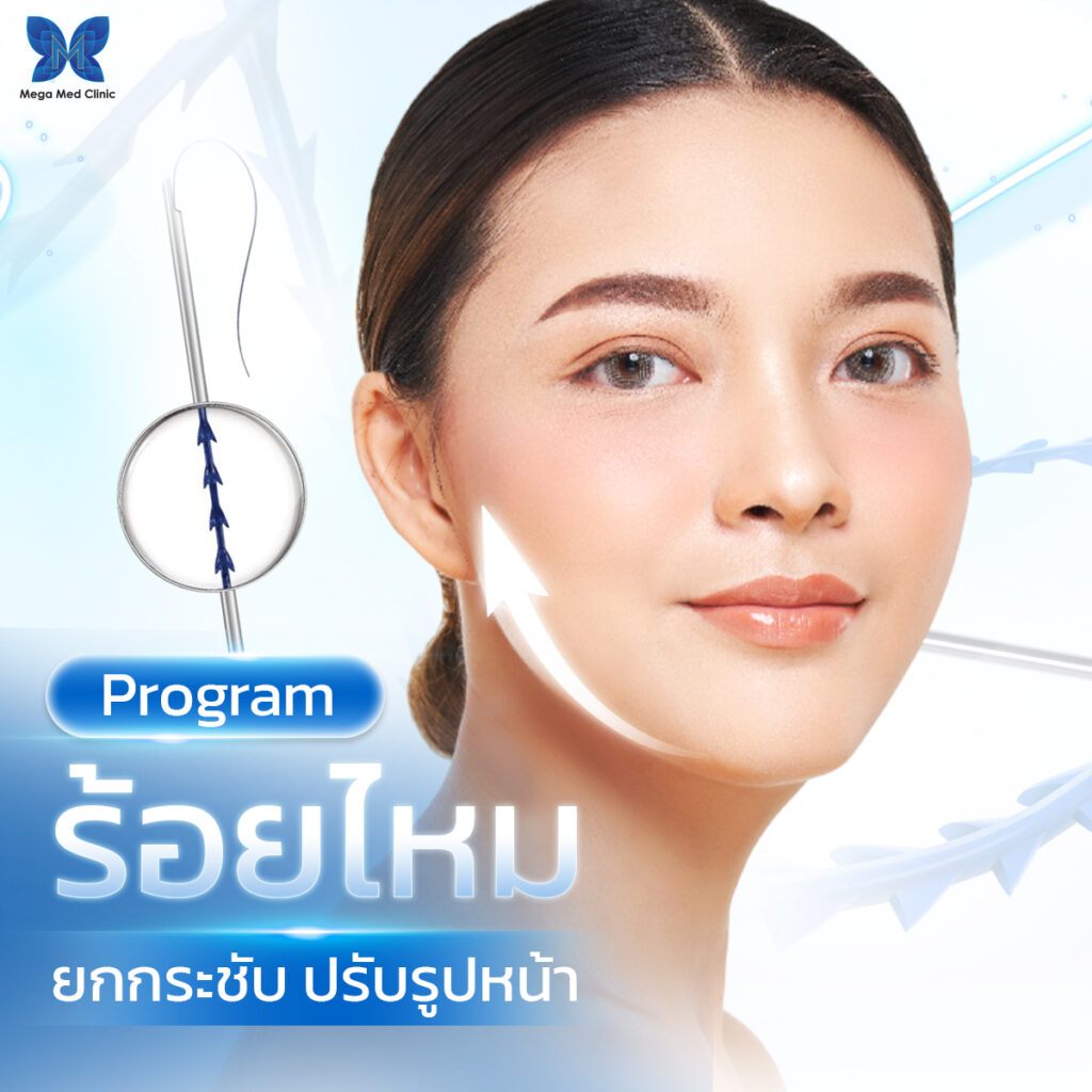 โปรแกรมร้อยไหมคืออะไร?